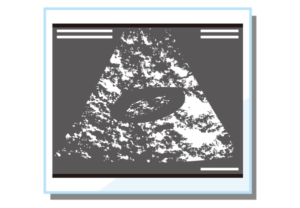 赤ちゃんのエコー写真保存で絶対にやってはいけないこと!